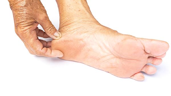 怎么治療跟腱炎和足底筋膜炎