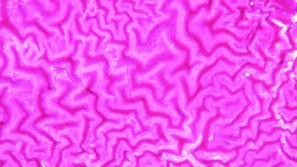 单核细胞数0.86严重吗
