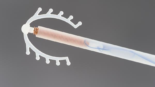 长期戴节育环对身体有什么影响