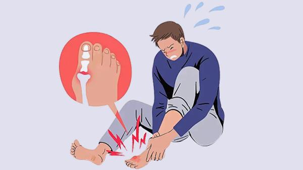 脚骨折二个月了还肿疼正常吗