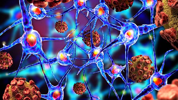 癌症容易“盯上”的人,多数都有这4个坏习惯,快看下你有没有?