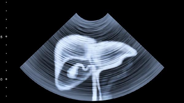 25岁后，该给身体器官做一下检查了，5大器官，需要你的关怀