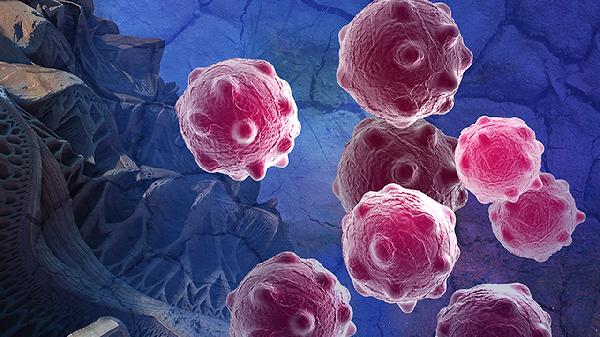 明明身体强壮,却被诊断出癌症?这几类人才要警惕