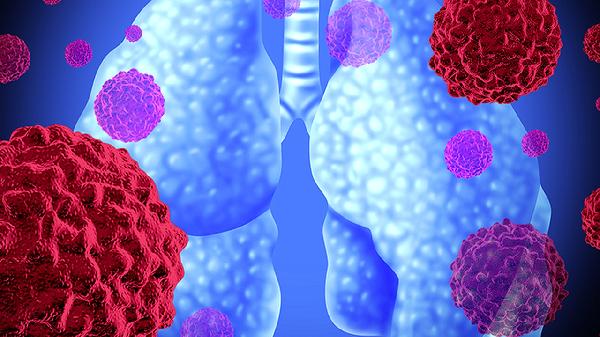 号称“夫妻癌”的四种癌症！如果其中一人有，另一半趁早去检查！