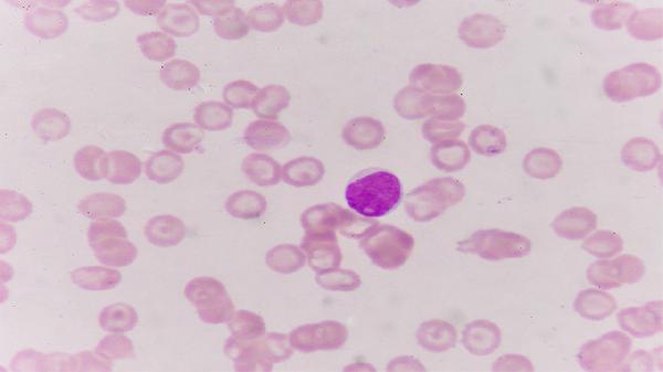 癌症患者饮食不盲目,谨记几大要点,加快康复速度,度过治疗期