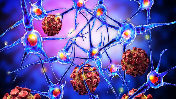 为什么农村得癌症的人越来越多?医生告诫:大多是因为这几个因素