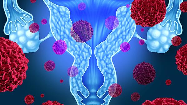 梳理近50年癌症数据发现:做好2件小事,能远离几种常见癌症!