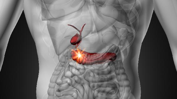 轉(zhuǎn)移性胰腺癌的治療方法有哪些