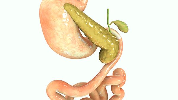 什么是胆源性慢性胰腺炎 胆源性慢性胰腺炎的四症状介绍