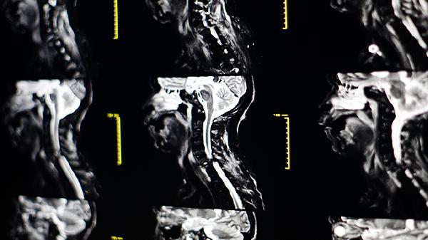 颈部淋巴结肿大挂什么科室