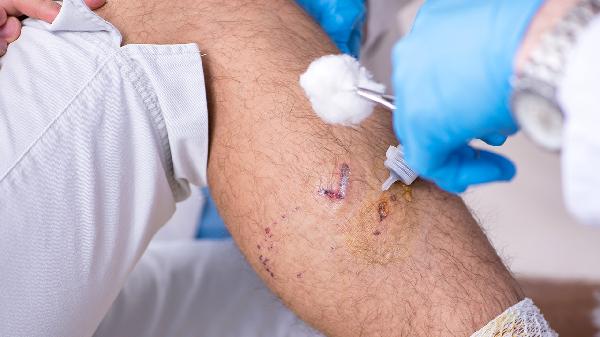 地砖被84消毒液腐蚀了怎么办