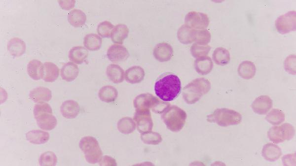 人乳头瘤病毒hpv52型阳性严重吗