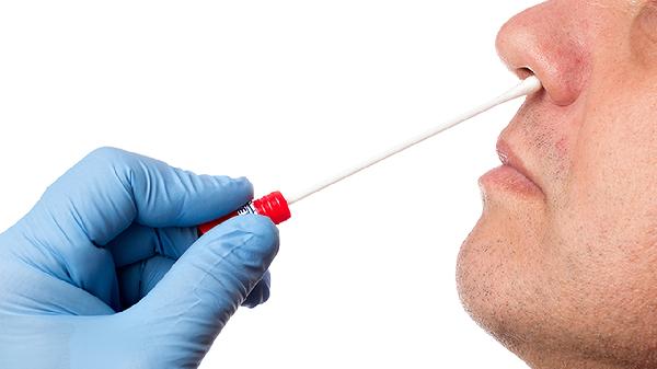 得了艾滋会不会查不出来只能查核酸