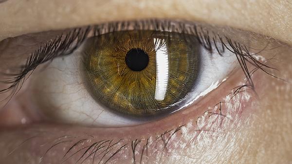 單純性突眼和浸潤性突眼的臨床表現(xiàn)