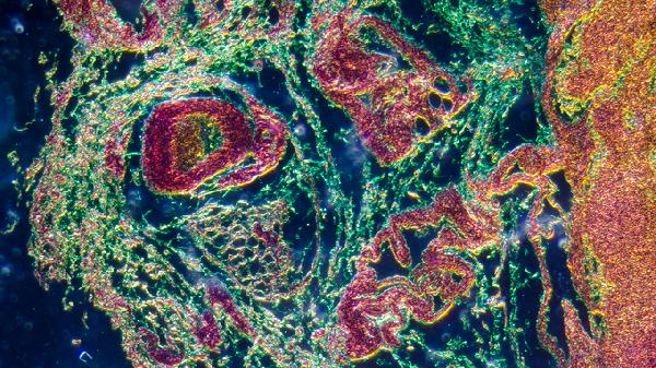 浴巾洗衣机洗完以后会不会有细菌