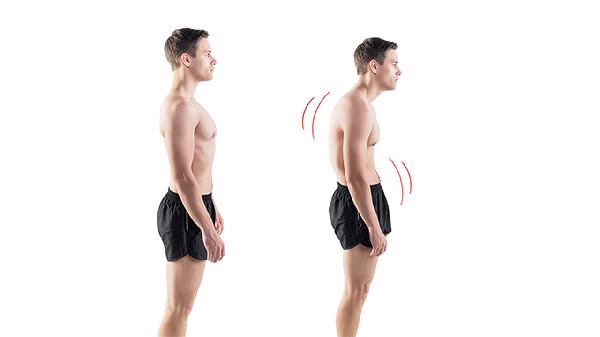 含胸驼背如何矫正最快最有效方法