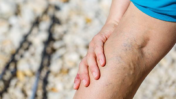 强化小腿内侧肌肉训练方法有哪些