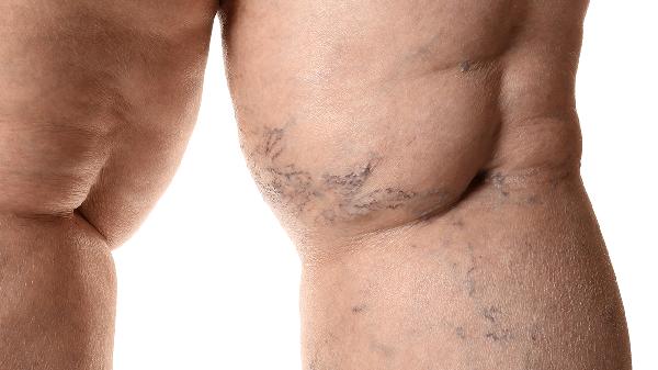 15岁孩子一个膝盖疼是怎么回事