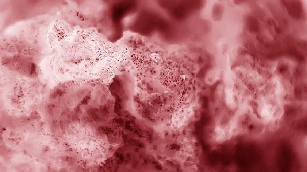 前庭大腺囊肿开始疼了是要消肿吗