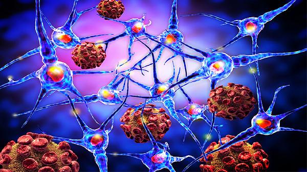 人疱疹病毒5型(巨细胞病毒)导致什么疾病
