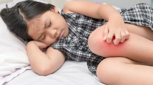 大腿根疼能自愈吗