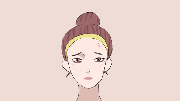 女生最简单的祛痘方法