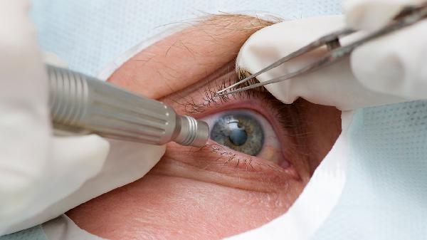 白内障流眼泪了考虑手术吗
