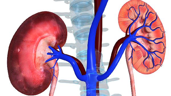 先天性腎積水怎么治療