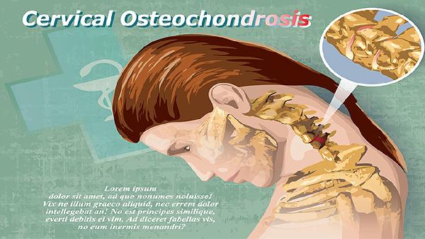 如何锻炼脖子肌肉保护颈椎功能