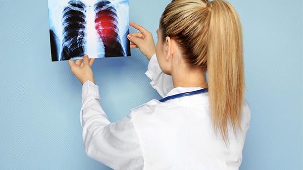 支原体肺炎后肺部还有少许炎症