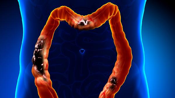 一上班就肠胃功能紊乱吃什么药