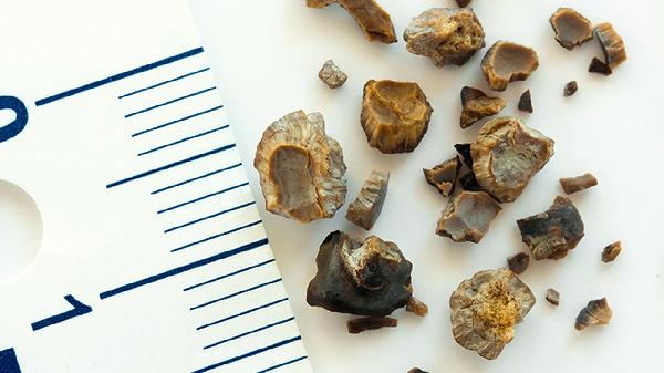 一般男孩子骨骼闭合是什么年龄