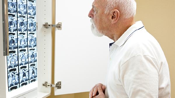 高位截瘫病人怎样锻炼腰部力量