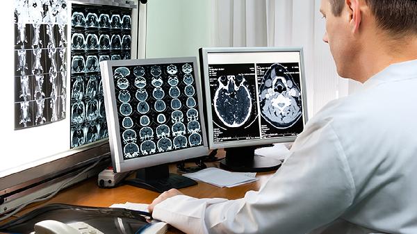 梗阻性腦積水與交通性腦積水的區(qū)別在于什么