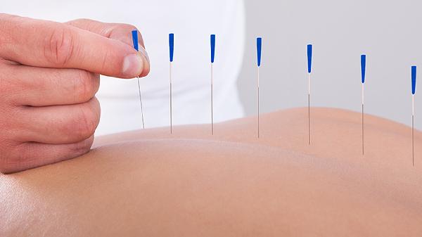 远红外理疗贴对腰间盘突出有用吗