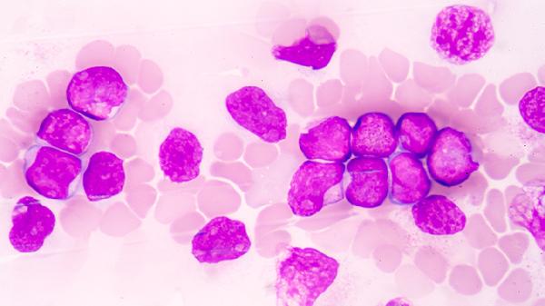 人粒细胞无形体病如何治疗