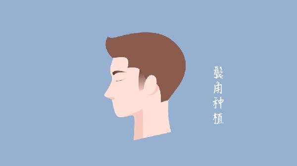 鬢角種植方法的流程有哪些