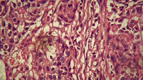 垂体前叶细胞可以分为哪几类