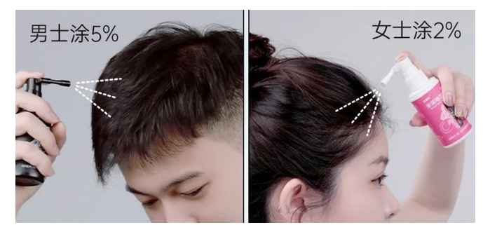 当脱发成为生活“不可承受之重”,达霏欣以科学解法破局突围