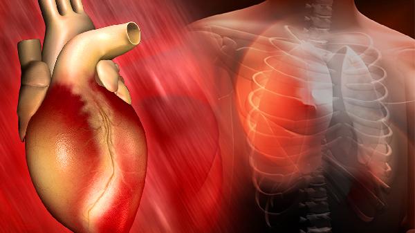 急性非st段抬高型心肌梗死是什么意思