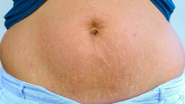 为什么皮肤会暗黄