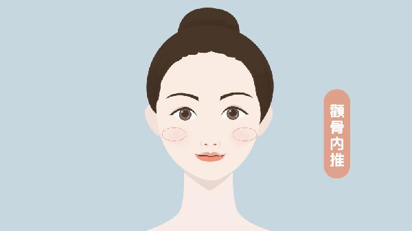 顴骨內(nèi)推的固定鋼釘要不要取出來(lái)
