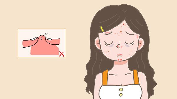 30多歲女人額頭長(zhǎng)痘痘怎么回事