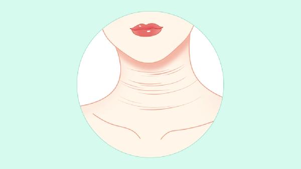 女人颈纹怎么形成的