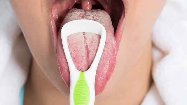 做牙冠用哪種材料好