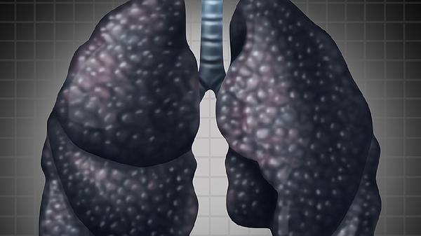 70歲老人得肺癌能活多久