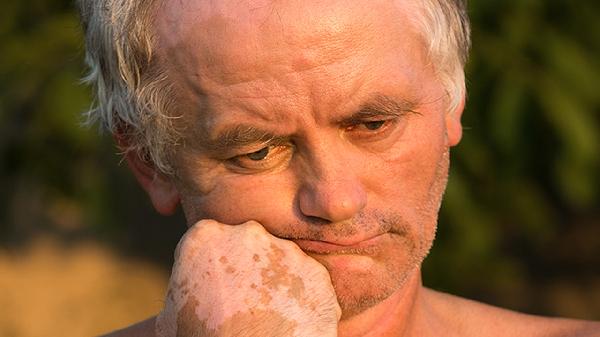 男性胯下两侧皮肤瘙痒挂什么科