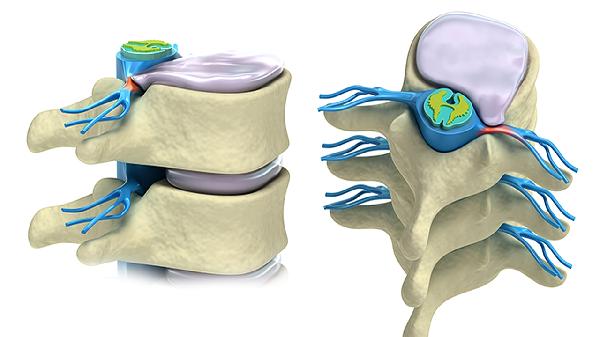 神经性皮炎引起飞龙体育比分直播游戏有哪些