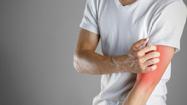 激素性皮炎到底会不会好转呢