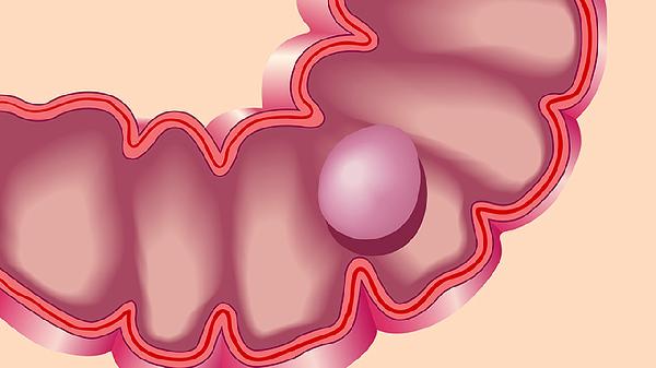 每天拍打臀部多少下能活血